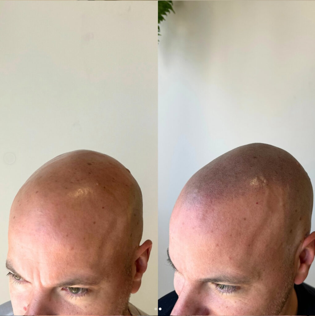 scalp micropig